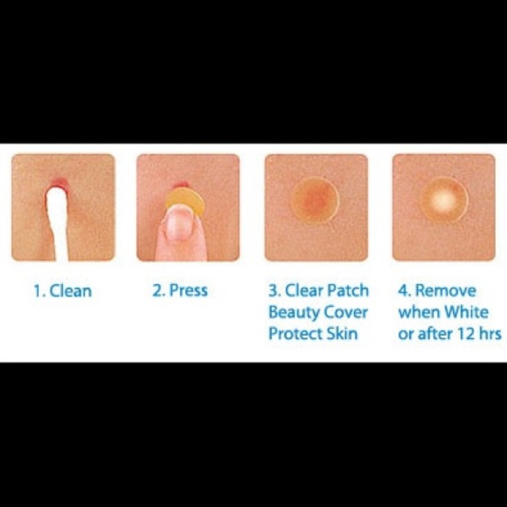 Acne patch - Picture 2 of 2